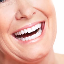 Sonoma Oral and Facial Surgery - All- On-4 (No more dentures)