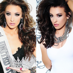 Eisenberg Ted, DO, FACOS, FAACS - Crystal Leigh Rush, Ms. United States 2014, before (left) and after (right) her breast augmentation by Dr. Ted Eisenberg.