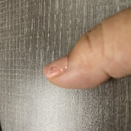Peeling gel polish in less than 24 hours Peeling gel polish in less than 24 hours