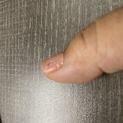 Peeling gel polish in less than 24 hours