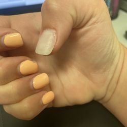 J-Nails - A week and 3 days after the first visit