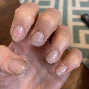 Lynn's Salon - Missing pointer nail, cracked middle and thumb nails. - Hair Salons Near Me - Chandler, Arizona