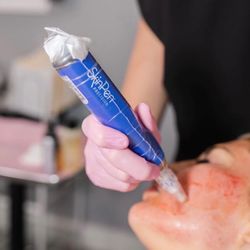 SOesthetic Med Spa - SkinPen Microneedling