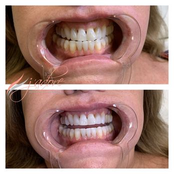 J'adore Clermont - Teeth whitening - Permanent Makeup Near Me - Clermont, Florida