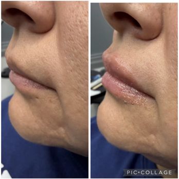 Madness Aesthetics - Skin Care Near Me - San Dimas, California Madness Aesthetics - Skin Care Near Me - San Dimas, California