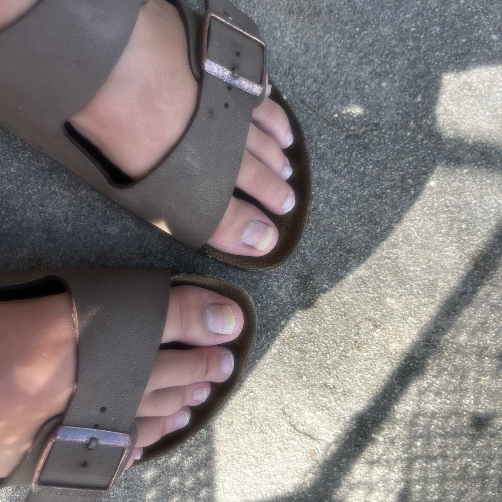 Modish Nails and Spa - On my big toes my nails have turned yellow and completely disconnected from my nail bed. - Nail Salons Near Me - Pooler, Georgia Modish Nails and Spa - On my big toes my nails have turned yellow and completely disconnected from my nail bed. - Nail Salons Near Me - Pooler, Georgia
