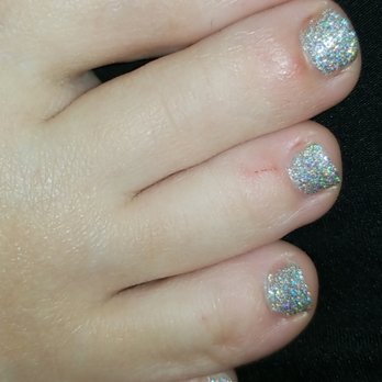 Soho Nail Spa - Another cut (3rd toe) - Nail Salons Near Me - Kansas City, Missouri Soho Nail Spa - Another cut (3rd toe) - Nail Salons Near Me - Kansas City, Missouri