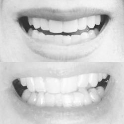 Katie Klein Orthodontics