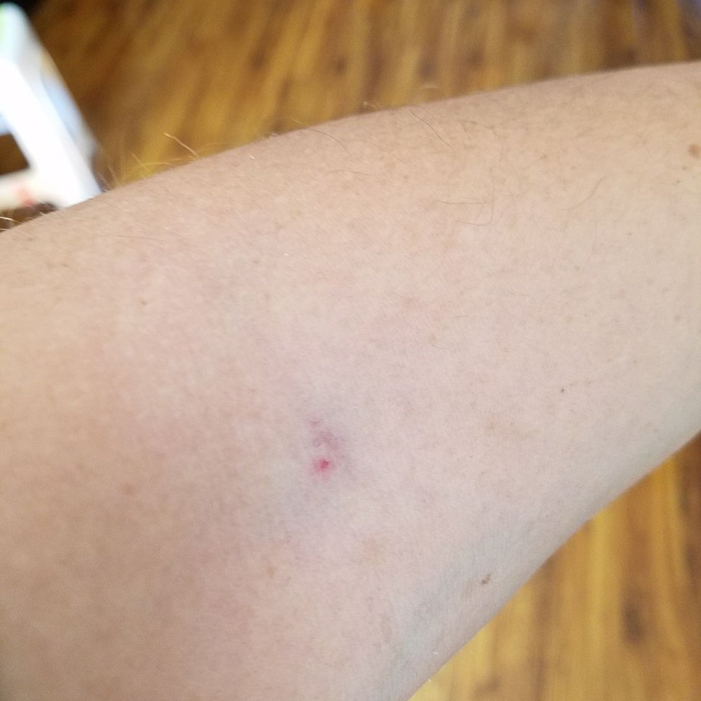 Sun Clinical Laboratories - Laboratory Testing Near Me - El Monte, California Sun Clinical Laboratories - Laboratory Testing Near Me - El Monte, California