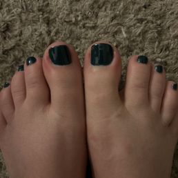 Cute color, but super sore big toes! You can see the redness on the sides!