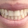 Blue Turtle Dental