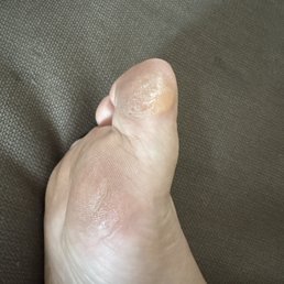 As you can see, I have clearly rough areas that the tech didn't touch with the pumice stone. As you can see, I have clearly rough areas that the tech didn't touch with the pumice stone.