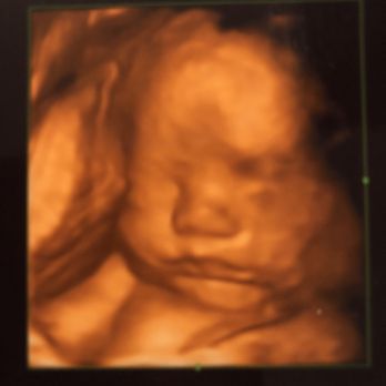 Baby Bump Studios - Diagnostic Imaging Near Me - Ontario, California Baby Bump Studios - Diagnostic Imaging Near Me - Ontario, California