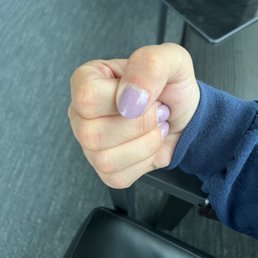 Really bumpy shellac and peeling skin