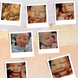 Precious Baby Peek Ultrasound - Max before and after photo comparison