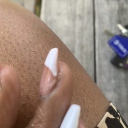 Solid Nails Spa - Air bubble in acrylic (cause acrylic to lift).