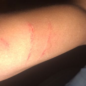 MacDinton's Irish Pub - Bruises from security after they waited for me to purchase 5 beers they dragged me out. Never again . - Sports Bars Near Me - Tampa, Florida MacDinton's Irish Pub - Bruises from security after they waited for me to purchase 5 beers they dragged me out. Never again . - Sports Bars Near Me - Tampa, Florida