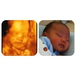 Sonohealth - 28w pregs, 5w old :) Thanks XDI!