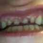 Photo of 212 Smiling