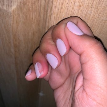 Holiday Nails - Had to take off some of the nail polish in order to try to heal my infection, it was inflamed - Nail Salons Near Me - Springfield, Missouri