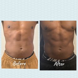 Body By Design Aesthetics Studio - Do you want more muscle definition? Ask us about the tools we use to burn fat and build muscle at the same time!