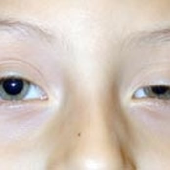 Sam Goldberger, MD - Pre Op - Cosmetic Surgeons Near Me - Beverly Hills, California Sam Goldberger, MD - Pre Op - Cosmetic Surgeons Near Me - Beverly Hills, California