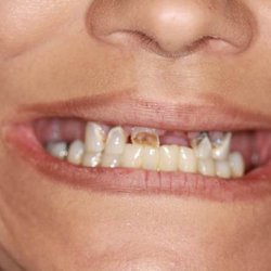 Richard Davis, DDS - 8:00am before
