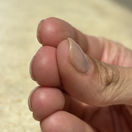 Gunk left under nails. Salon neglected to properly clean around actual nail