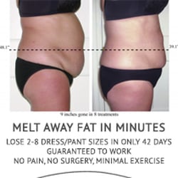 Webster Weight Loss - Come get your results today.