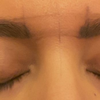 Delicate Touch Esthetics by Mylene - First picture is to show the initial asymmetry. The subsequent pictures are of my eyebrows immediately after and once the scabs fell off. - Permanent Makeup Near Me - Fair Oaks, California