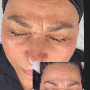 Glorious Lashes 46:5 - Radio frequency face treatment. - Estheticians Near Me - Las Vegas, Nevada Glorious Lashes 46:5 - Radio frequency face treatment. - Estheticians Near Me - Las Vegas, Nevada