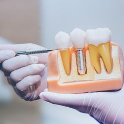Parkway Family Dental