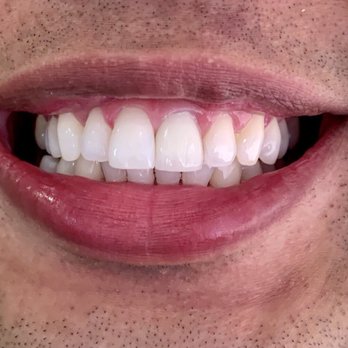 Just Dental - General Dentistry Near Me - Westminster, California Just Dental - General Dentistry Near Me - Westminster, California