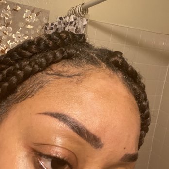 Mybrows Studio & Academy - 2 days later Healing process of Right eybrow - Permanent Makeup Near Me - Rancho Cucamonga, California Mybrows Studio & Academy - 2 days later Healing process of Right eybrow - Permanent Makeup Near Me - Rancho Cucamonga, California