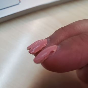 Nail Bar & Spa - Went in for an acrylic fill-in Got nails done 7/3 and this is 6 days later 7/9. Lumpy and uneven - Nail Salons Near Me - Ann Arbor, Michigan Nail Bar & Spa - Went in for an acrylic fill-in Got nails done 7/3 and this is 6 days later 7/9. Lumpy and uneven - Nail Salons Near Me - Ann Arbor, Michigan