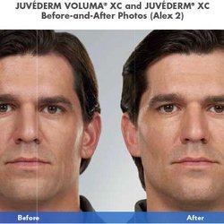 Metroderm DC - SculpSure Washington, DC