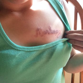 Ink off me - Ink off me first time!! - Tattoo Removal Near Me - Stockton, California Ink off me - Ink off me first time!! - Tattoo Removal Near Me - Stockton, California