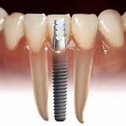 Talent Dental - Rancho Cucamonga, CA