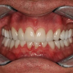 A Life of Smiles - AFTER image - Smile Makeover