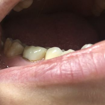 Green Line Dental Care - General Dentistry Near Me - Boston, Massachusetts