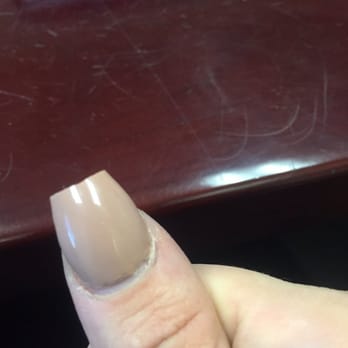 P--p a-d P----h - 4 days after (broken nail) - Nail Salons Near Me - Chula Vista, California P--p a-d P----h - 4 days after (broken nail) - Nail Salons Near Me - Chula Vista, California