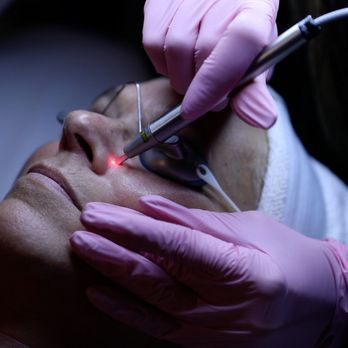 Blaine Plastic Surgery - Plastic Surgeons Near Me - New York, New York Blaine Plastic Surgery - Plastic Surgeons Near Me - New York, New York