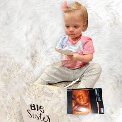 Wonderful reveals - This baby is watching her baby sister for the first time on 3D ultrasound with Wonderful Reveals #3Dultrasound  #statenisland