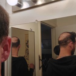 Bombshellz Beauty Bar - Bald spot under scar on the back and sides was not filled in as agreed upon. Scar runs from the back of the ear to the other side.