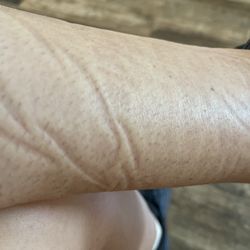 Equestrian Fashion Outfitters - this is what happens to my lower calf when I even try to put them on for a half hour