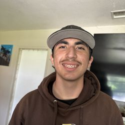 Chino Family Dental - First day of braces