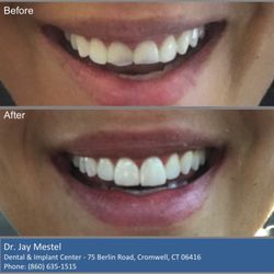 Dental & Implant Center