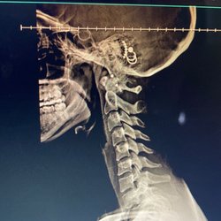California Imaging & Diagnostics - cervical spine lateral view