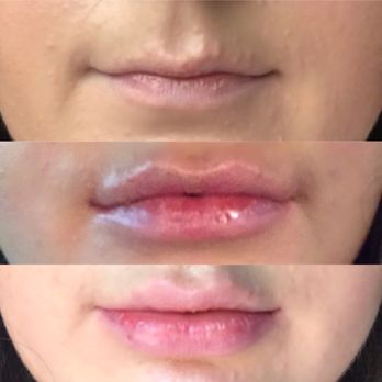 Christopher C Chang, M.D - Congressional Plastic Surgery - Before--right after appt--day after - Cosmetic Surgeons Near Me - Chevy Chase, Maryland Christopher C Chang, M.D - Congressional Plastic Surgery - Before--right after appt--day after - Cosmetic Surgeons Near Me - Chevy Chase, Maryland