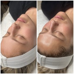 Lash Lounge 79 - Deep cleanse and refreshing glow!
